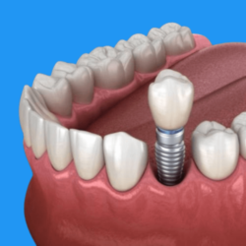 Clareamento-dental-nova-serrana__2_-removebg-preview (2) Clareamento-dental-nova-serrana__2_-removebg-preview (2)