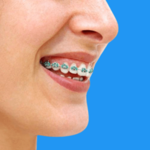 Clareamento-dental-nova-serrana__3_-removebg-preview (1) (1) Clareamento-dental-nova-serrana__3_-removebg-preview (1) (1)