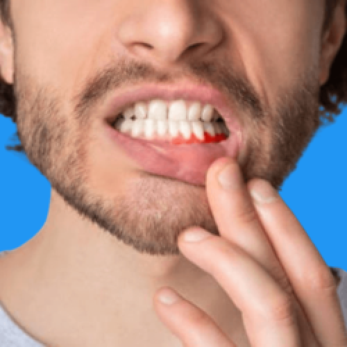 Clareamento-dental-nova-serrana__6_-removebg-preview (2) Clareamento-dental-nova-serrana__6_-removebg-preview (2)